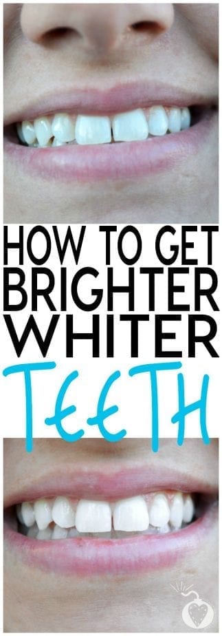 How can I actually have whiter teeth?
