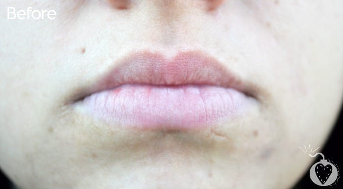lips before