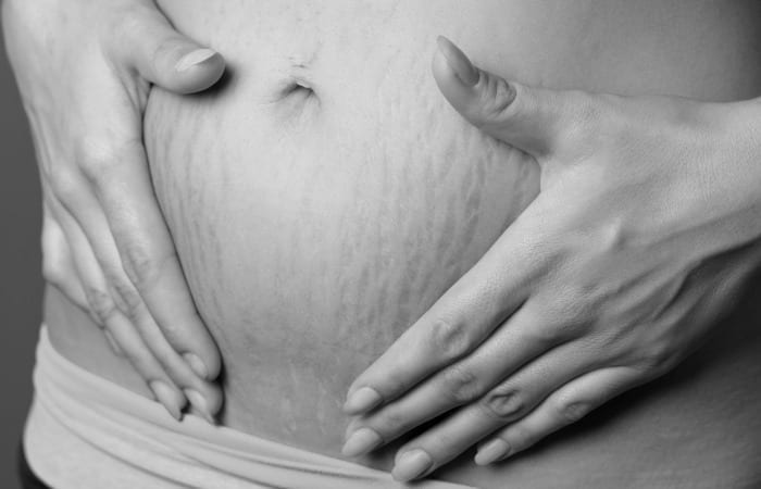 I Put Off Intimacy With My Husband After Pregnancy Because I Was Ashamed Of My Body