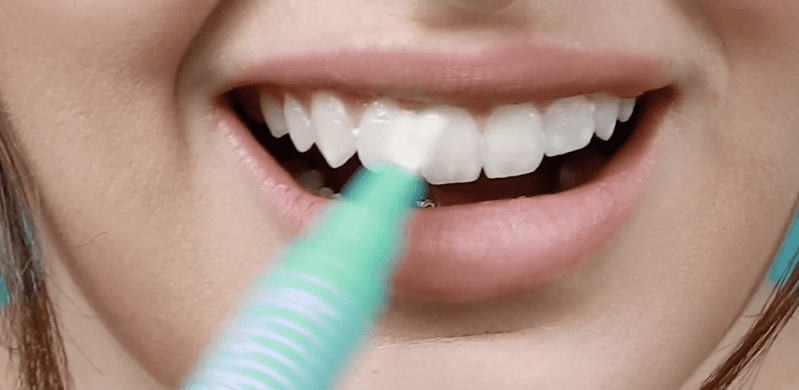 Everyone I Know Is Freaking Out About This Teeth Whitening Pen From A Makeup Company