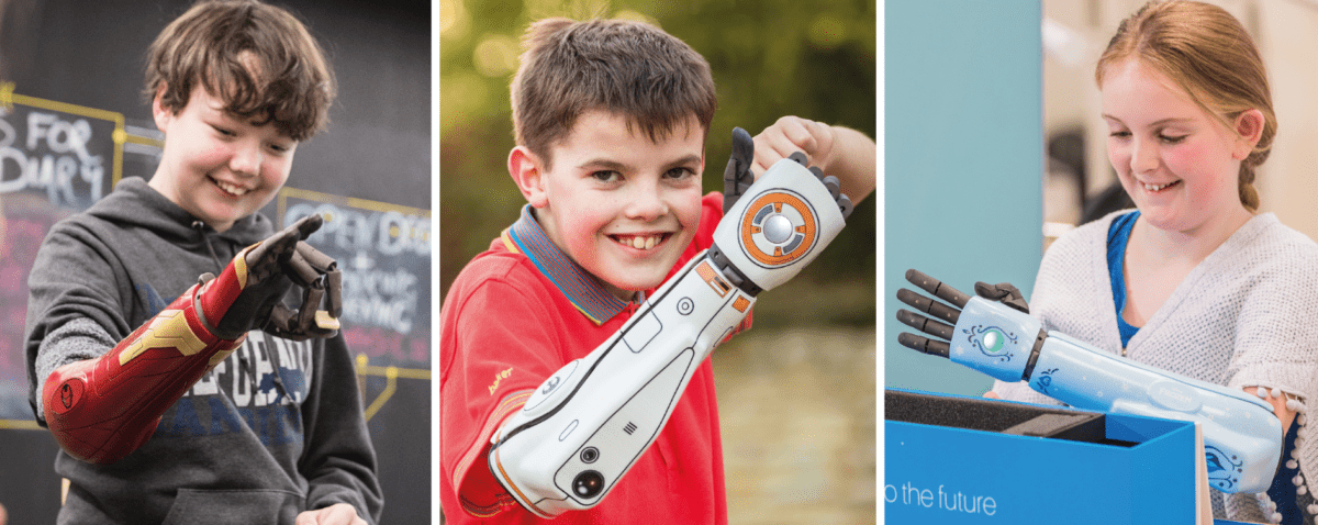 This Company Gives Free  Disney Covers to Kids With  Bionic Arms