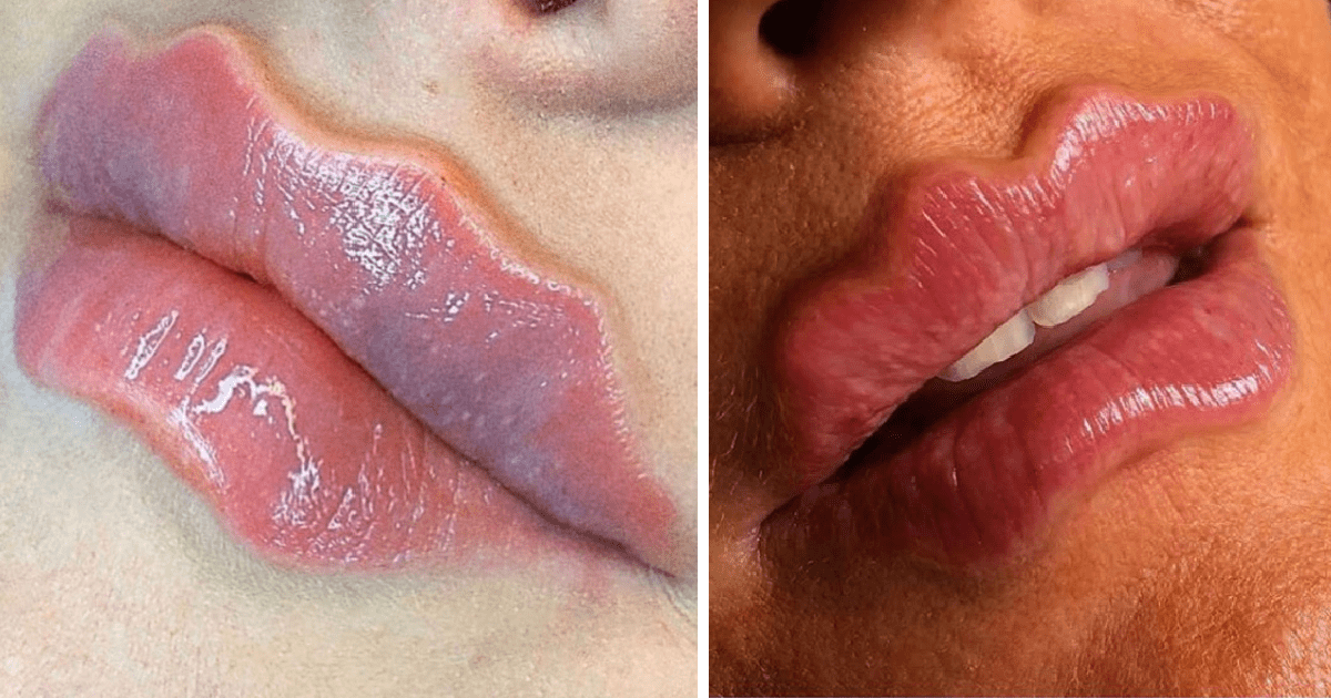 ‘Wavy Lips’ Are The New Beauty Trend And I’m A Bit Freaked Out
