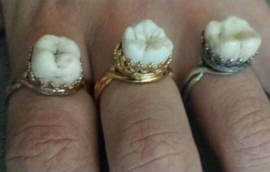 People Are Getting Jewelry Made From Loved Ones Teeth and I’m So Horrified, I’ll Never Sleep Again