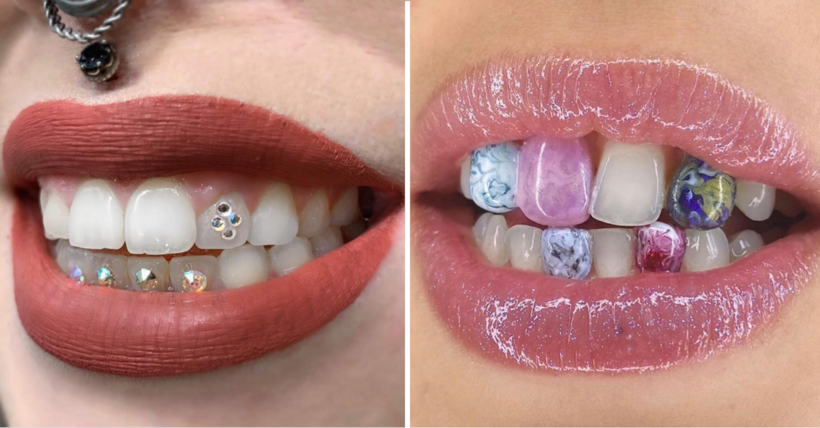 Tooth Gems' Is The New Hot Beauty Trend and I Don't Hate Them