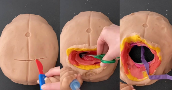 This Doctor Recreates Surgeries Using Play-Doh To Educate Her Kids and It’s The Coolest Thing Ever