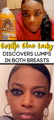 update on gorilla glue lady