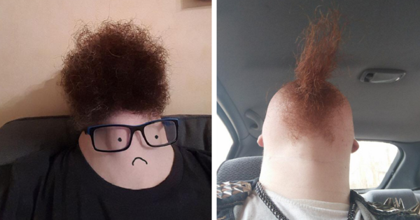 ‘Beards From Below’ Is The Hot New Trend Among Men And It’s The Weirdest Thing You’ll See Today!
