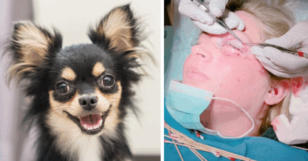 This Girl Got Her Eyelid Ripped Off By A Dog And It Is Terrifying