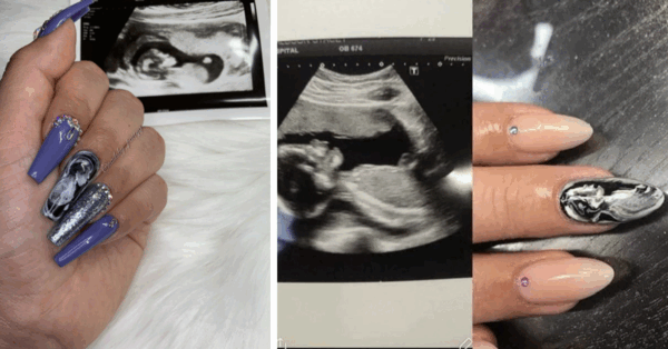 ‘Ultrasound Nails’ Are The Hottest New Beauty Trend For New Moms