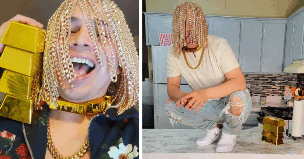This Guy Had Gold Chains Surgically Implanted Into His Scalp And It Just Sounds Painful