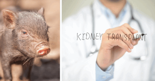 The First Pig To Human Kidney Transplant Has Been Done And It Is Fascinating