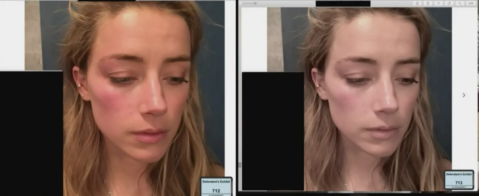 Metadata Expert Witness Testifies Amber Heard’s Alleged Abuse Photos Look Edited