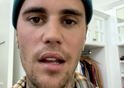 Justin Bieber Says He’s Battling A Serious Virus That Causes Parts of His Face to Be Paralyzed
