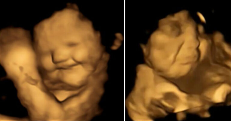 Study Says Fetuses Smile for Carrots But Frown Over Kale and I Totally Get It
