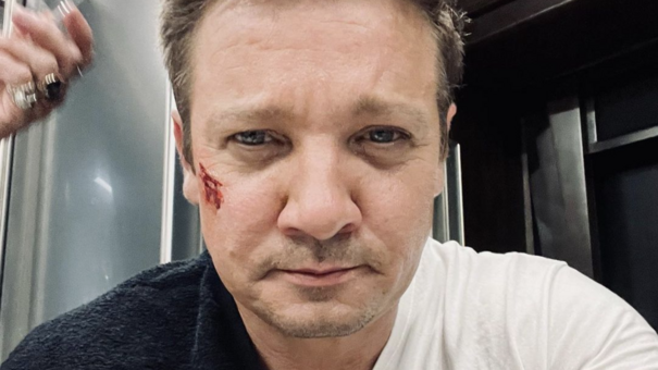New Jeremy Renner Update States He’s Suffered Massive Blood Loss