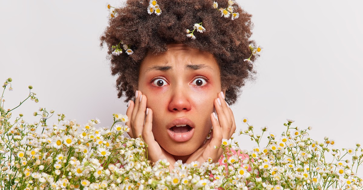 Allergies Are Worse Than Ever Right Now. Here’s What Scientists Are Saying About It.